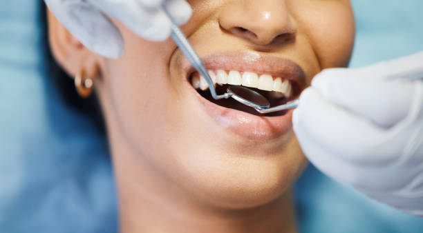 Best 24-Hour Emergency Dental Care in Monterey, CA