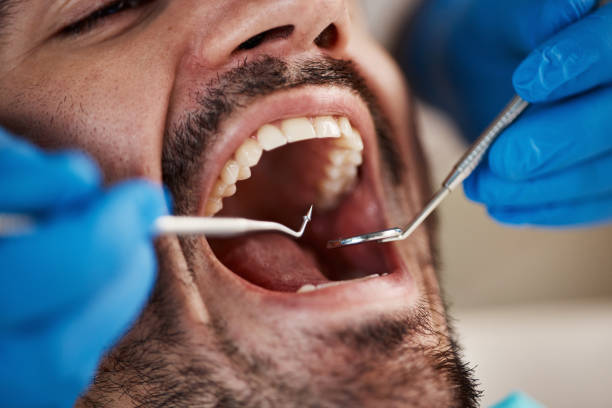 Best Broken or Chipped Tooth Repair in Monterey, CA